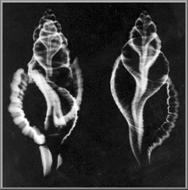 Xray Of Faux Cymatium pileare (Linnaeus, 1758)